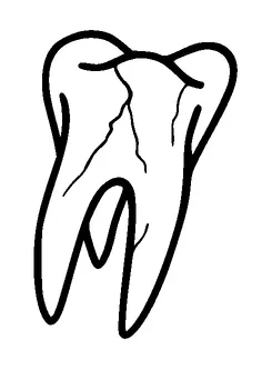 Broken Tooth Tattoo Meaning, PNG and SVG